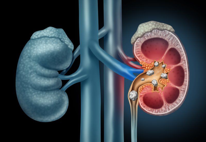Nephrology / Urology